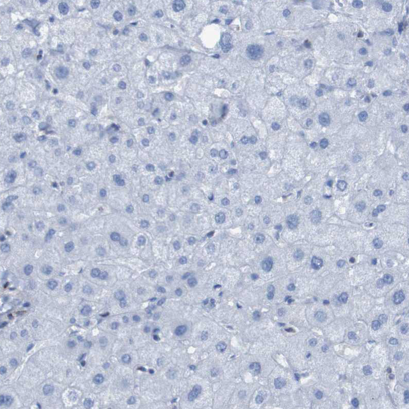 Rabbit Polyclonal Anti-RNF182 Antibody - Buy for research - Highly ...