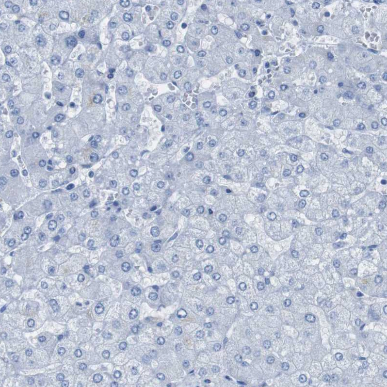 Anti-PTPRZ1 Human Protein Atlas Antibody