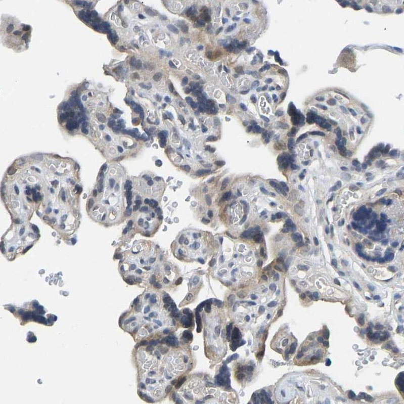 NDRG3 (P6) Rabbit mAb main image 1