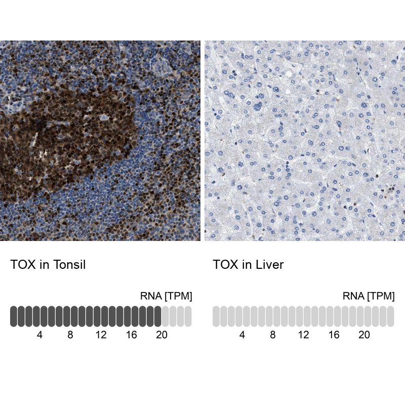 Anti-TOX Human Protein Atlas Antibody