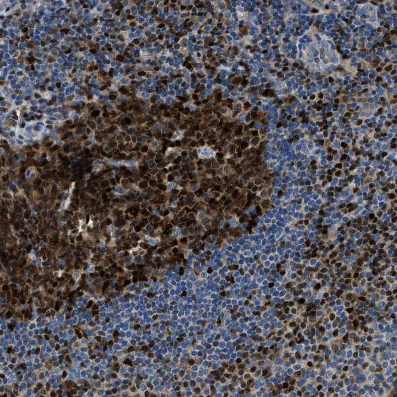 Anti-TOX Human Protein Atlas Antibody