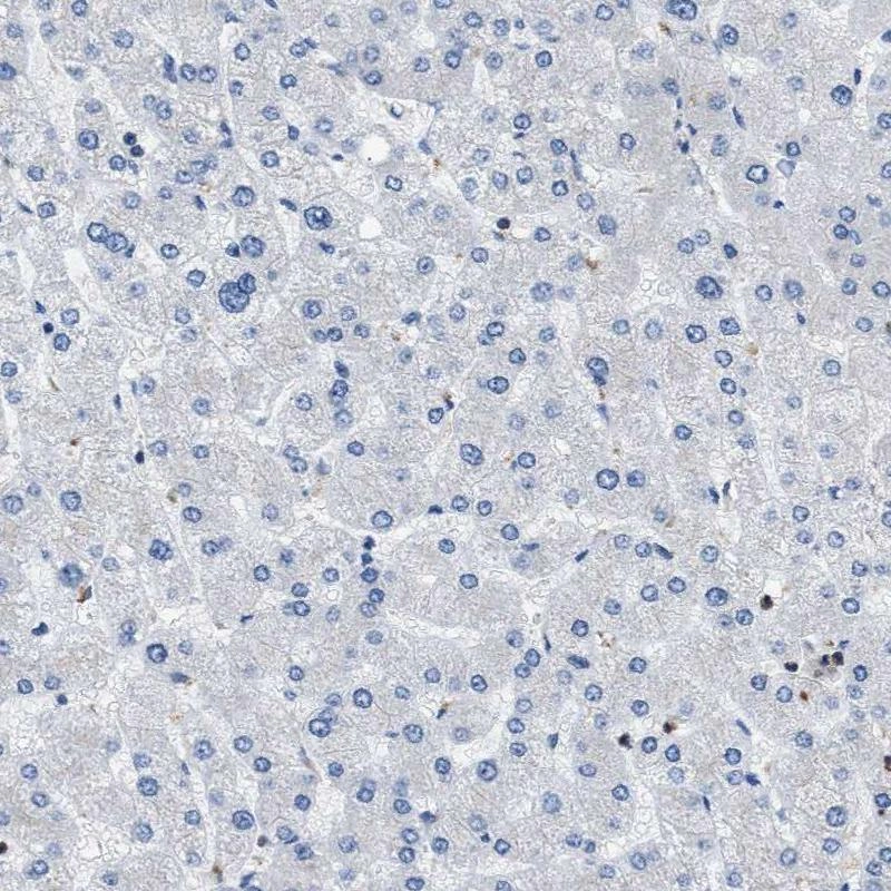 HPA018322-ihc-5.jpg