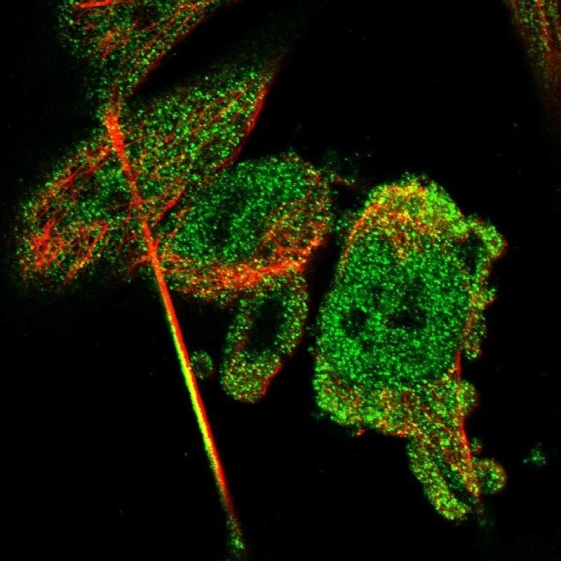 Anti-CBR3 Human Protein Atlas Antibody