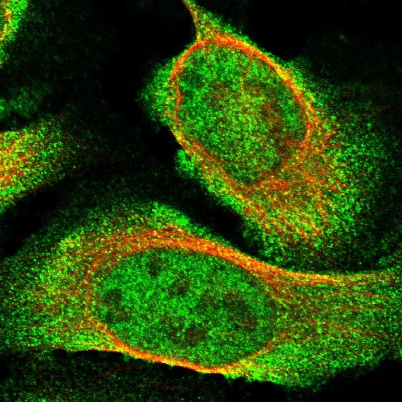 Anti-USP16 Human Protein Atlas Antibody
