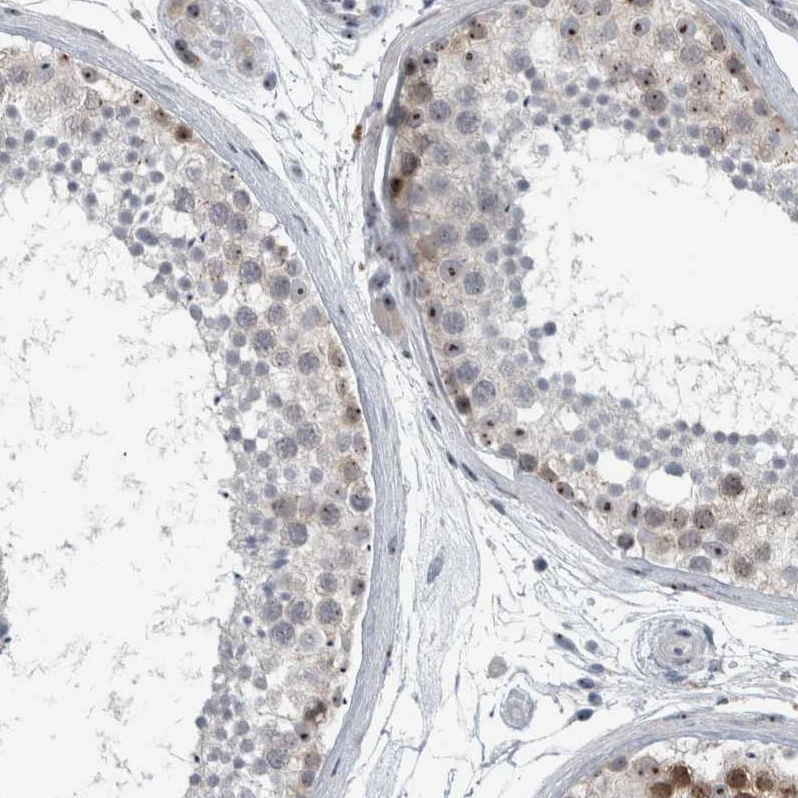Utp6 Anti-UTP6 Human Protein Atlas Antibody