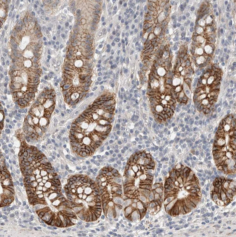 Hcn3 Anti-HCN3 Human Protein Atlas Antibody