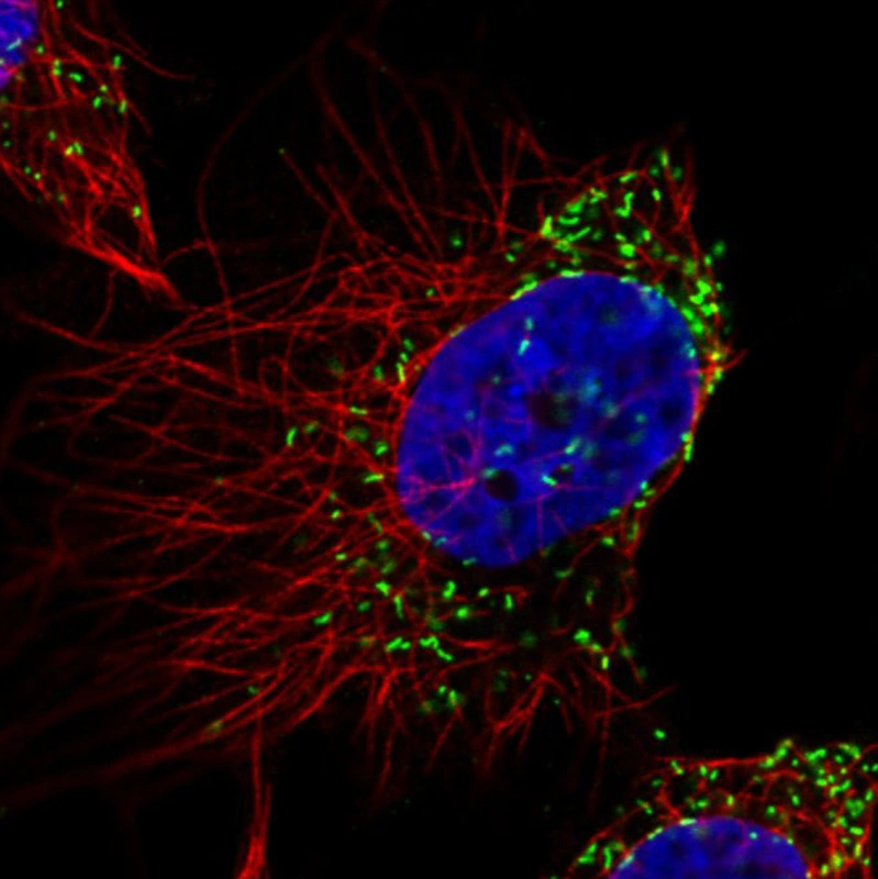 Anti-ABCD3 Monoclonal Atlas Antibody