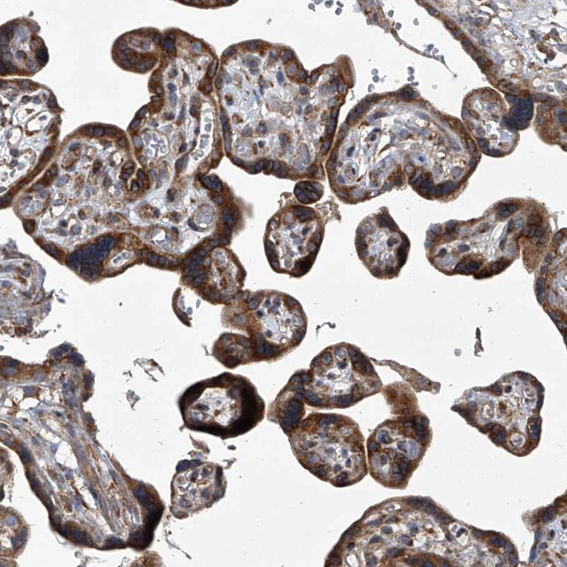 Anti-ZC3H15 Human Protein Atlas Antibody