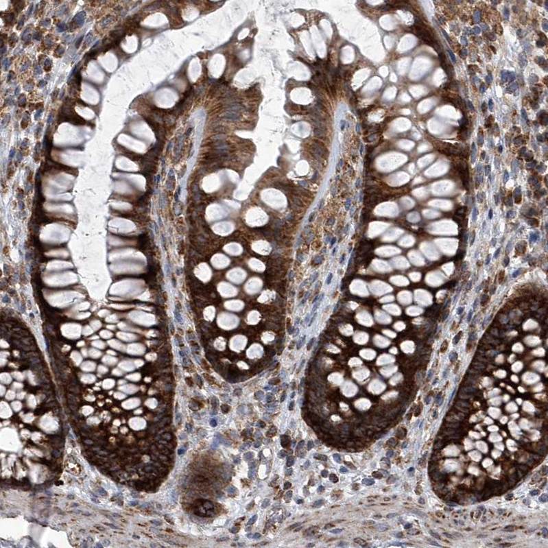 Anti-ZC3H15 Human Protein Atlas Antibody