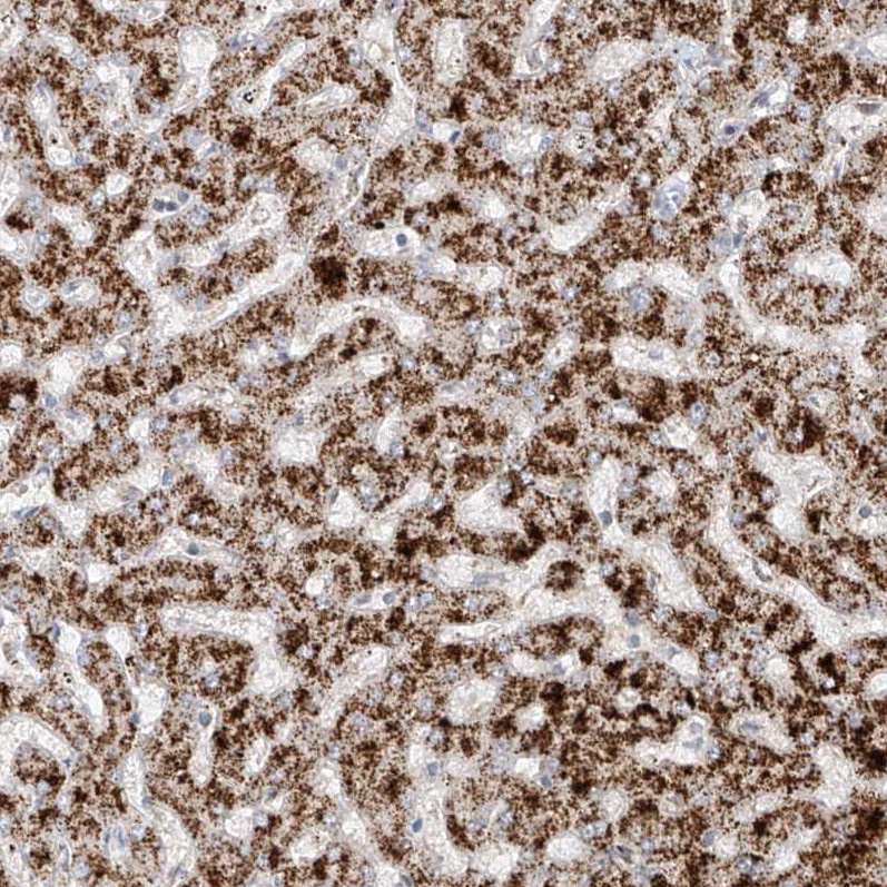 Anti-ABCD3 Human Protein Atlas Antibody