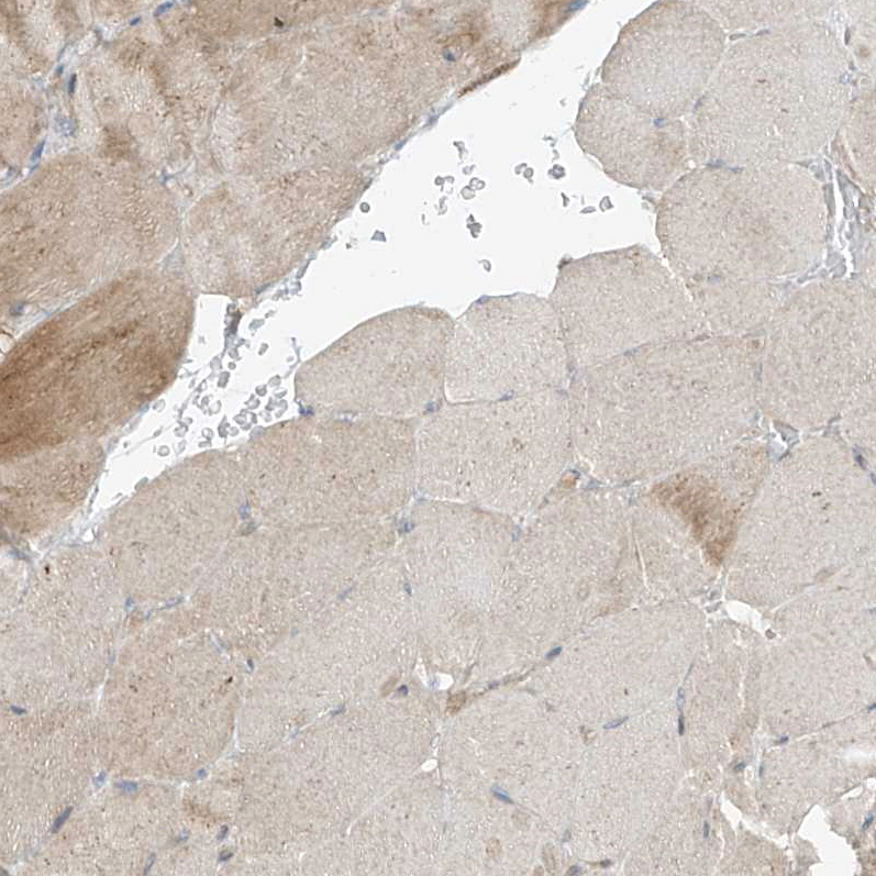 Anti-ABCD3 Human Protein Atlas Antibody