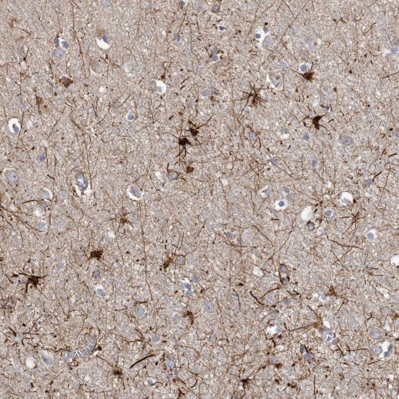 Rabbit Polyclonal AntiMCAT Antibody Buy for research Highly