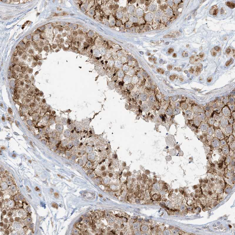 Rabbit Polyclonal AntiMCAT Antibody Buy for research Highly