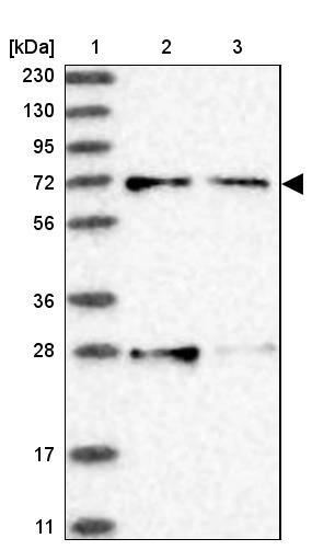 Acox3 Anti-ACOX3 Human Protein Atlas Antibody
