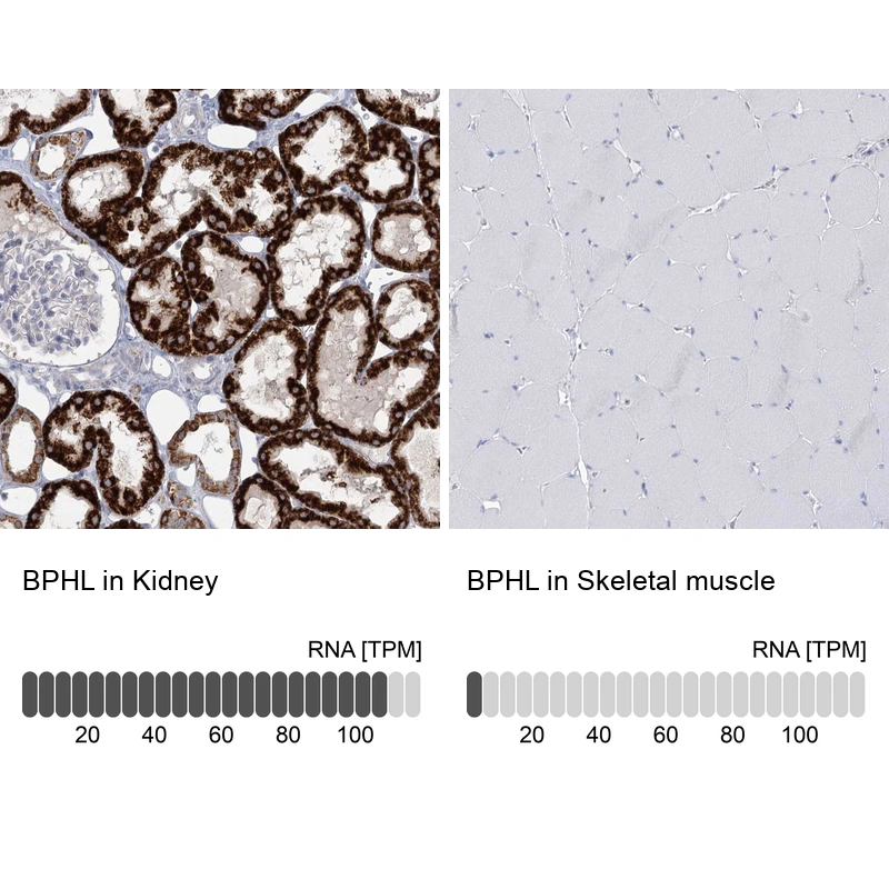 Anti-BPHL Human Protein Atlas Antibody