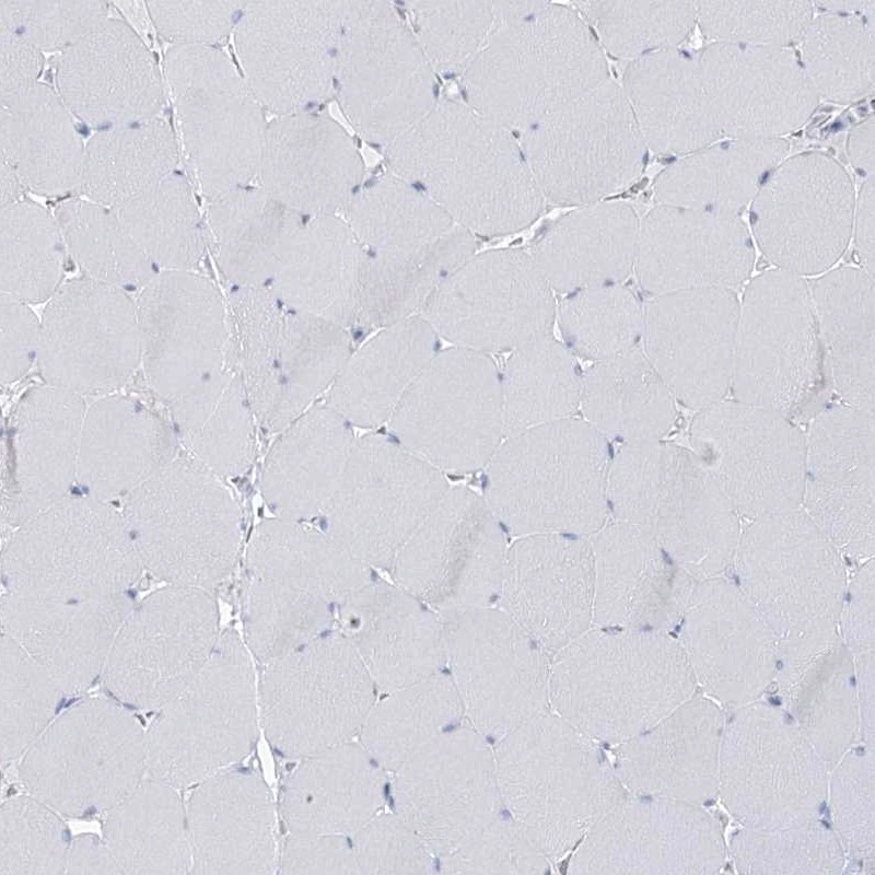 Rabbit Polyclonal Anti-BPHL Antibody - Buy for research - Highly ...