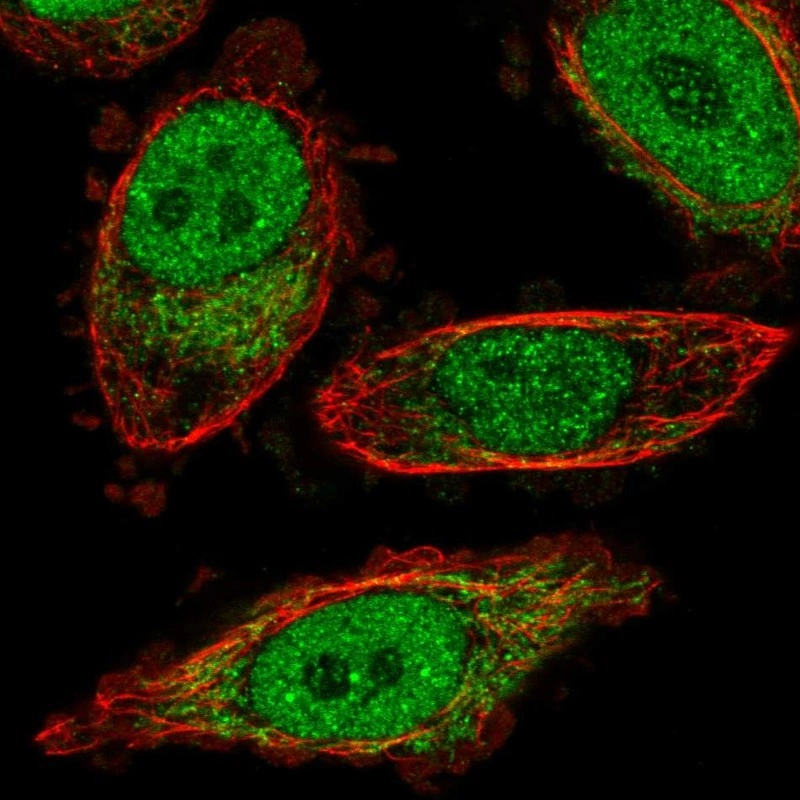 Anti-BPHL Human Protein Atlas Antibody