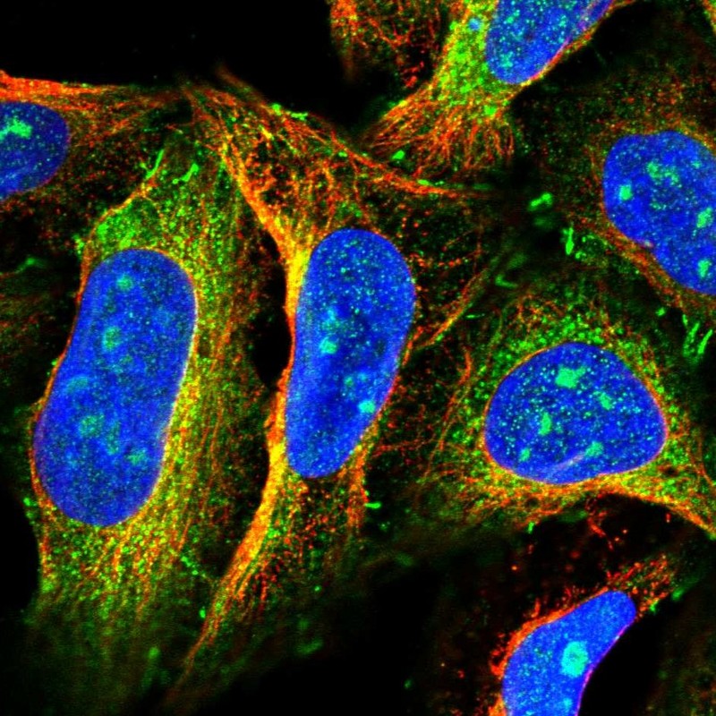 2025年激安 Rabbit Polyclonal research for Buy - Antibody Anti-FAM13A その他