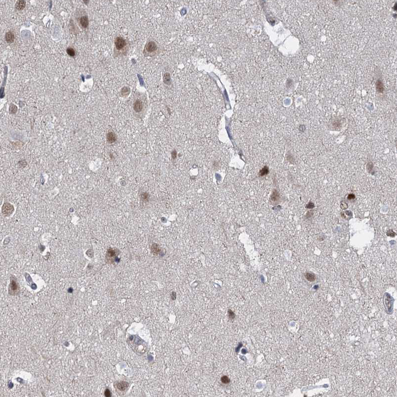 uakmd様 Rabbit Polyclonal Anti-PSMD4 Antibody - Buy for research