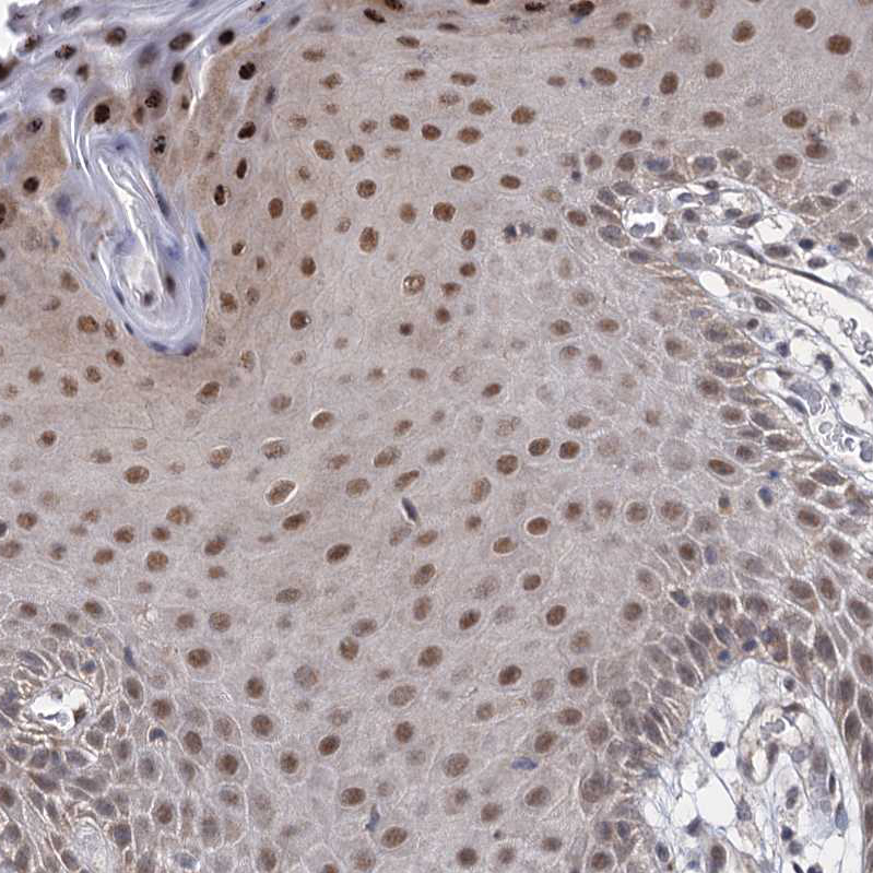 uakmd様 Rabbit Polyclonal Anti-PSMD4 Antibody - Buy for research