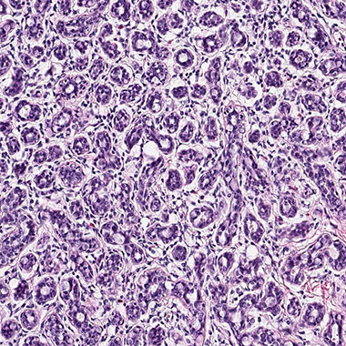 Using our anti-RAI2 polyclonal antibody in breast cancer research