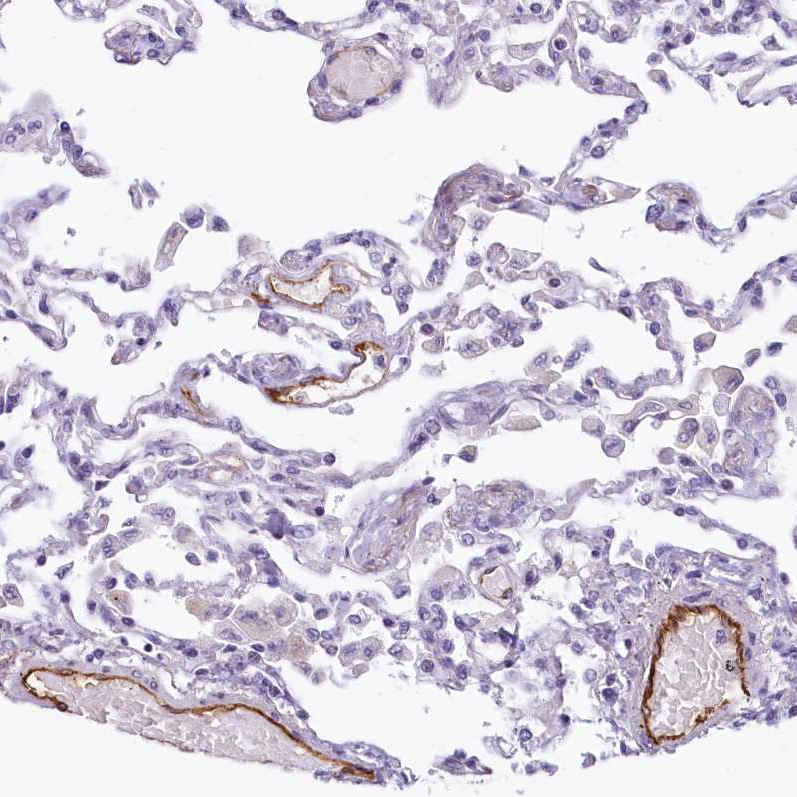 Anti-PROCR Human Protein Atlas Antibody
