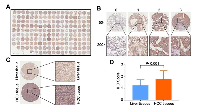 Using anti-PPAT polyclonal antibody (HPA036091) in liver cancer research