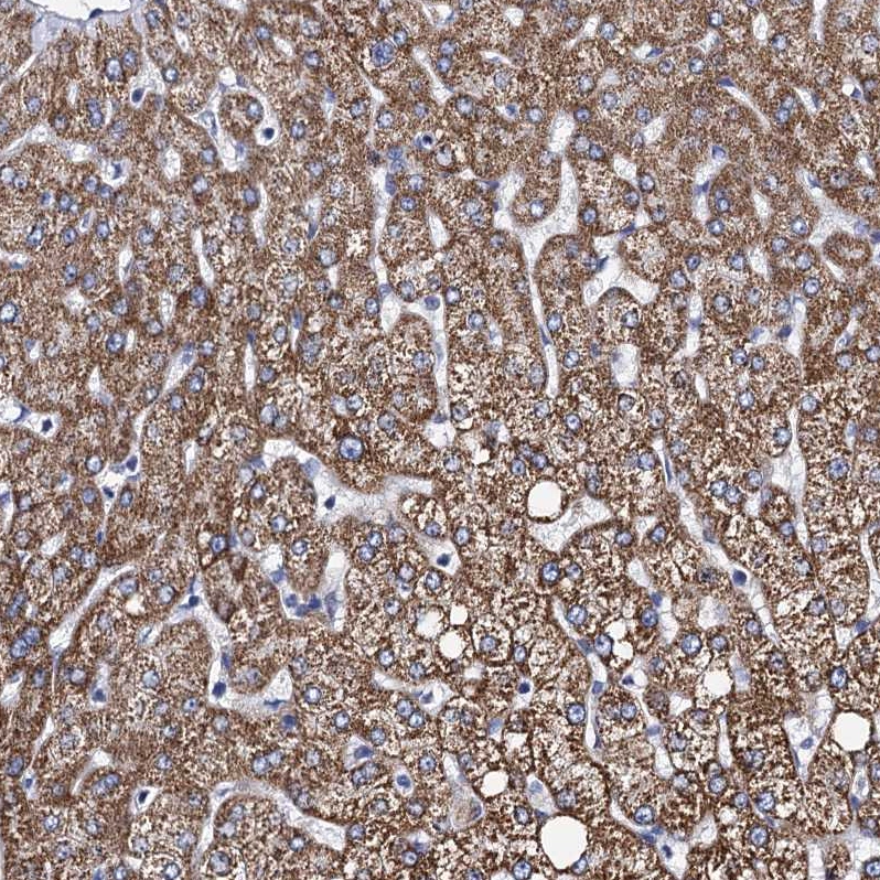 Acadsb Anti-ACADSB Human Protein Atlas Antibody