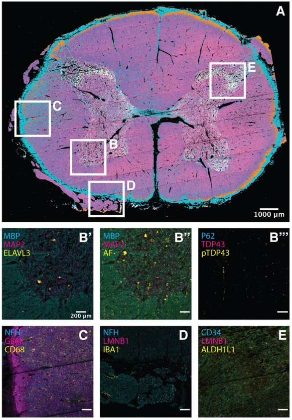 The image shows high-plex 4i tissue profiling from postmortem ALS patient spinal cords on fresh frozen tissue sections.