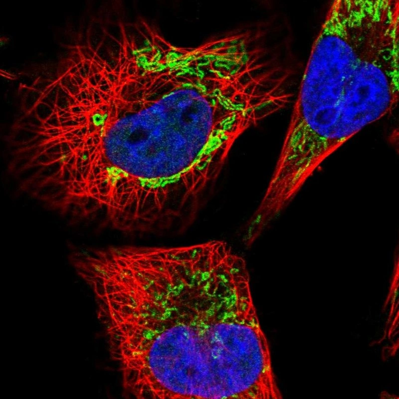Antidsd Lab Anti-DLD Human Protein Atlas Antibody