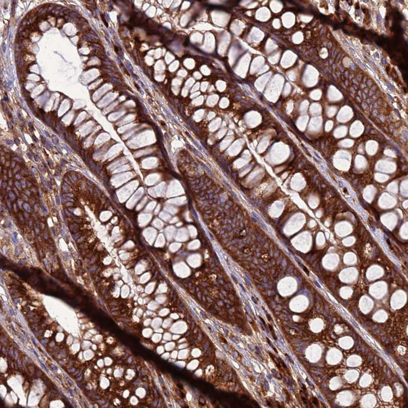 hama様 Rabbit Polyclonal Anti-ZC3HAV1 Antibody - Buy for research