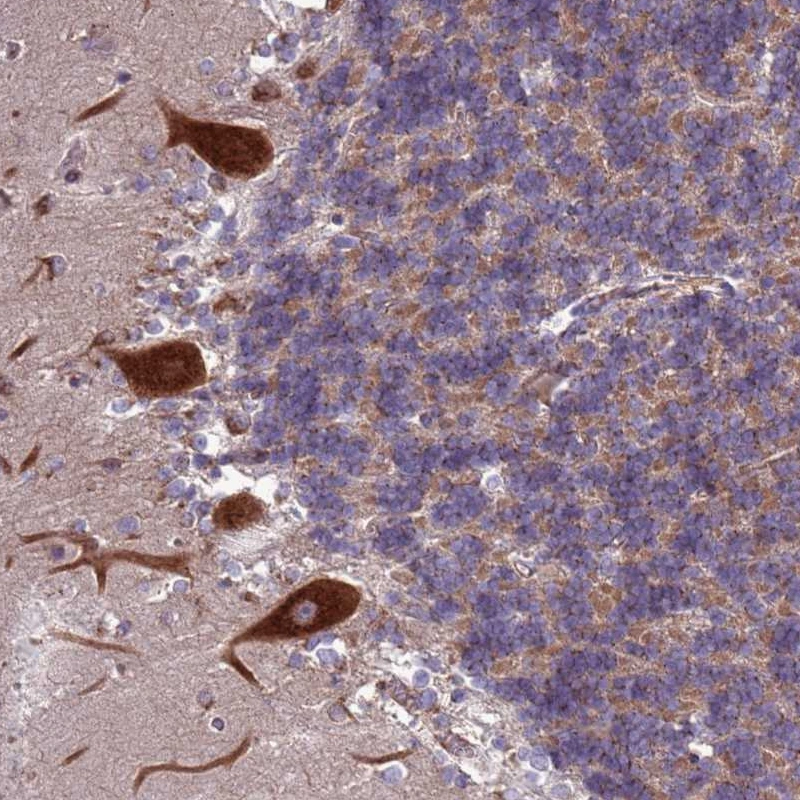 Anti-ZC3HAV1 Human Protein Atlas Antibody