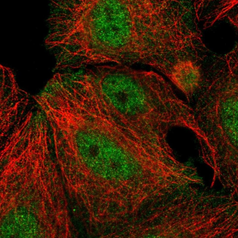 Anti Rashda B Anti-RASD1 Human Protein Atlas Antibody