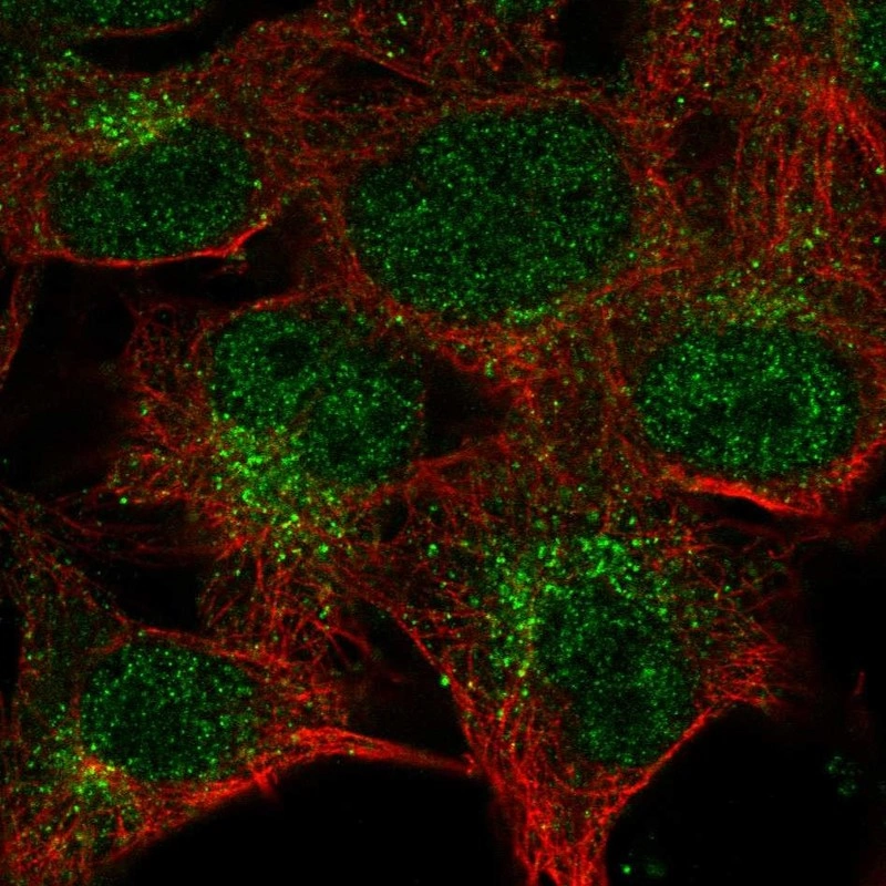 Anti-CTSK Human Protein Atlas Antibody