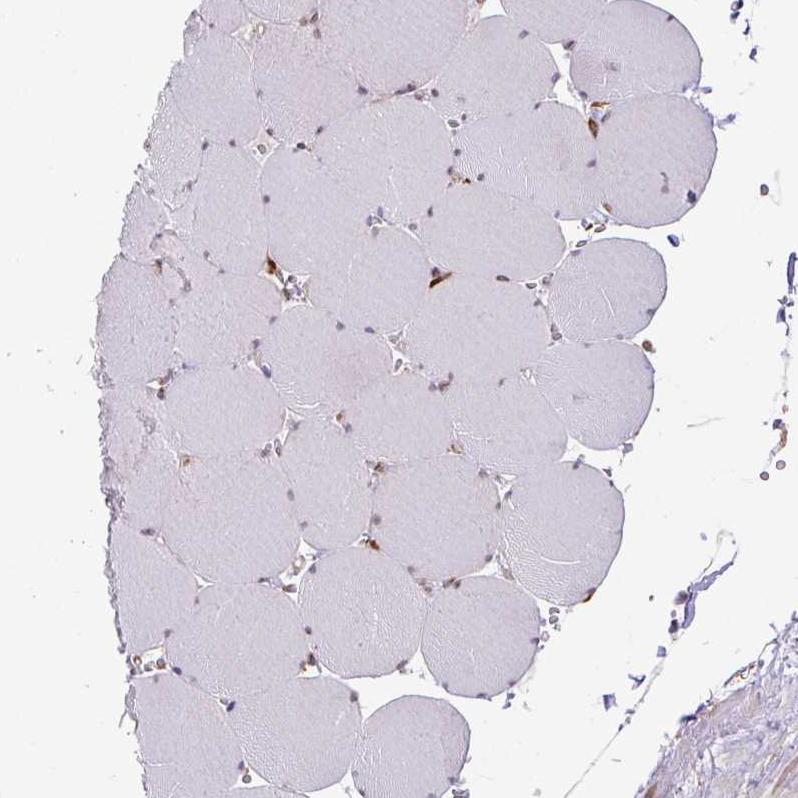 Rabbit Polyclonal Anti-SLC39A7 Antibody - Buy for research