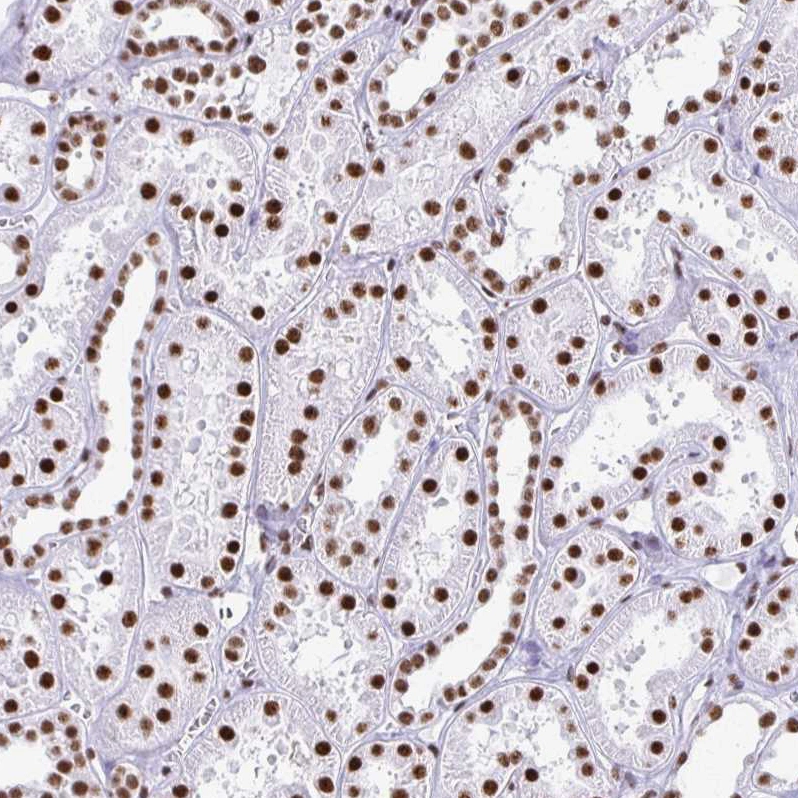 HONO様確認用 Anti-NONO Human Protein Atlas Antibody