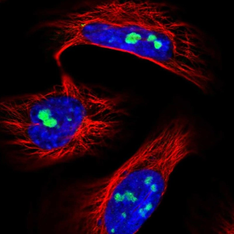 Utp6 Anti-UTP6 Human Protein Atlas Antibody
