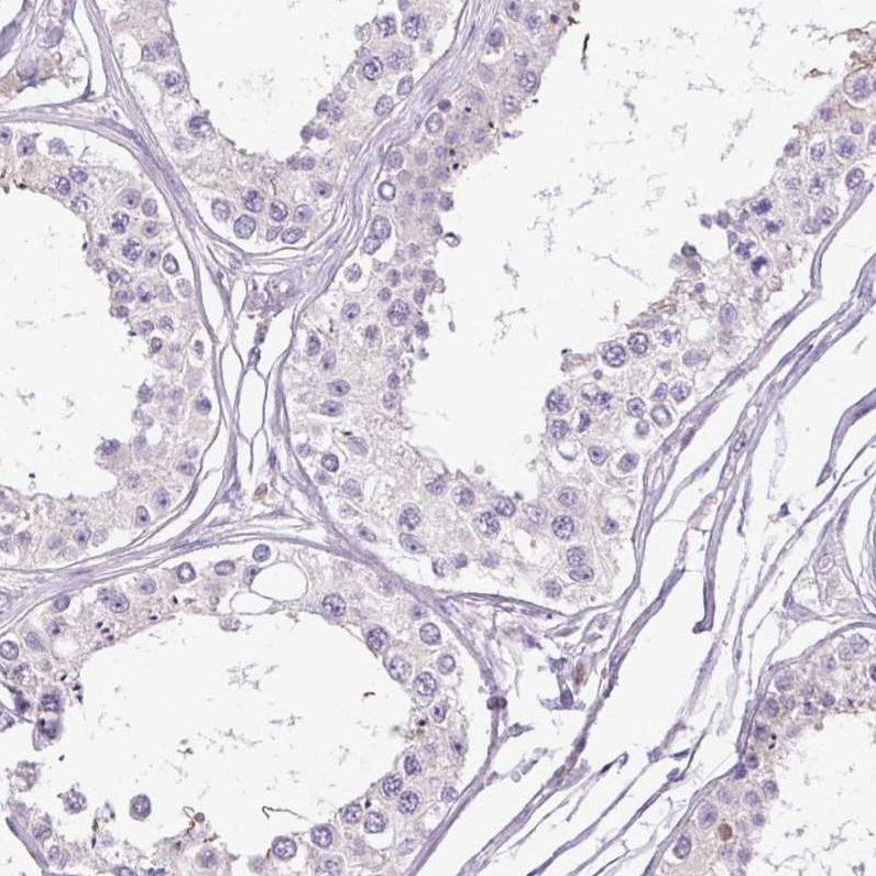 Antihex Anti-HEXB Human Protein Atlas Antibody