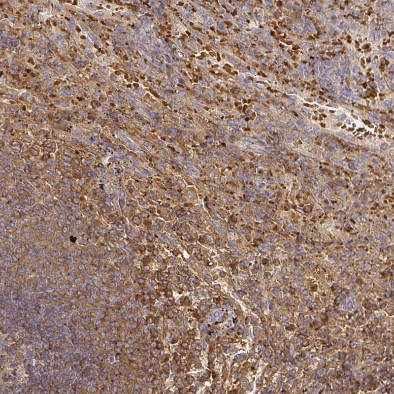 Photo inspiration: Visual Reference: Anti Fgf21 Human Protein Atlas Antibody