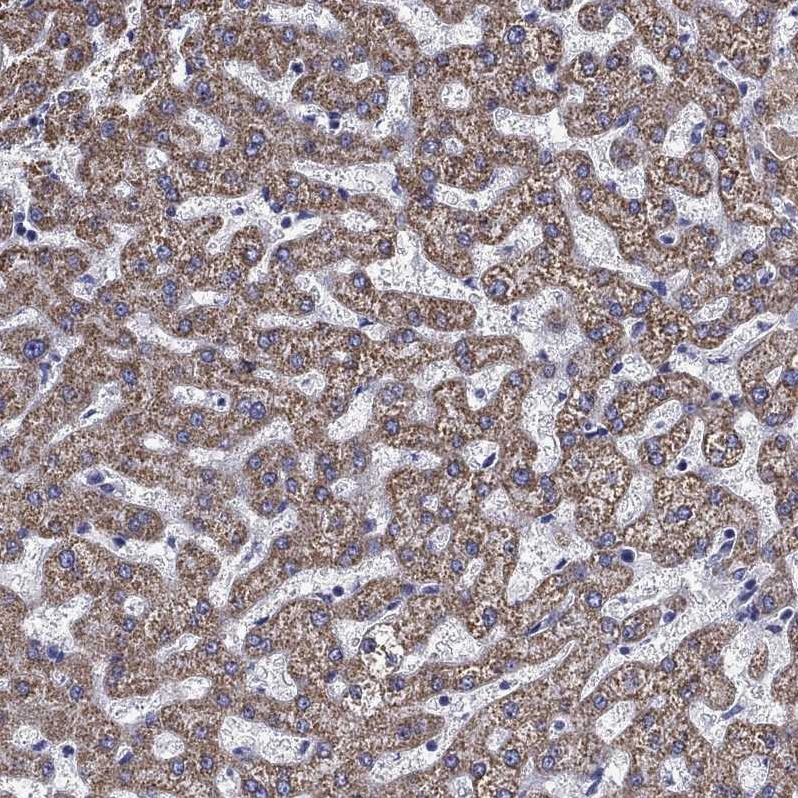 Acadsb Anti-ACADSB Human Protein Atlas Antibody