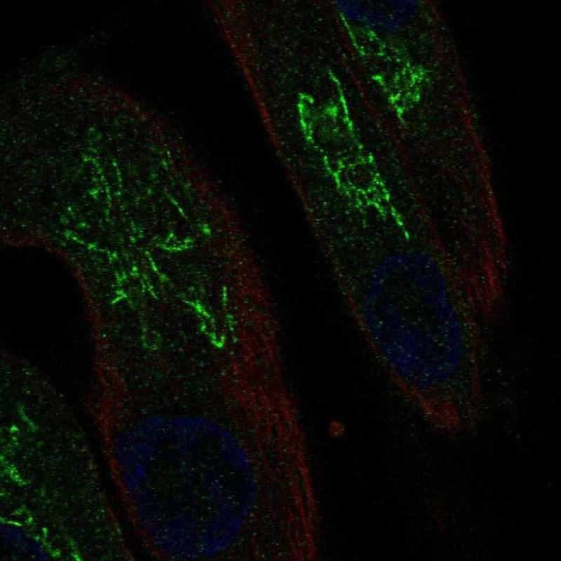 Mal Antibody Reactions To Participation Severity During Pars