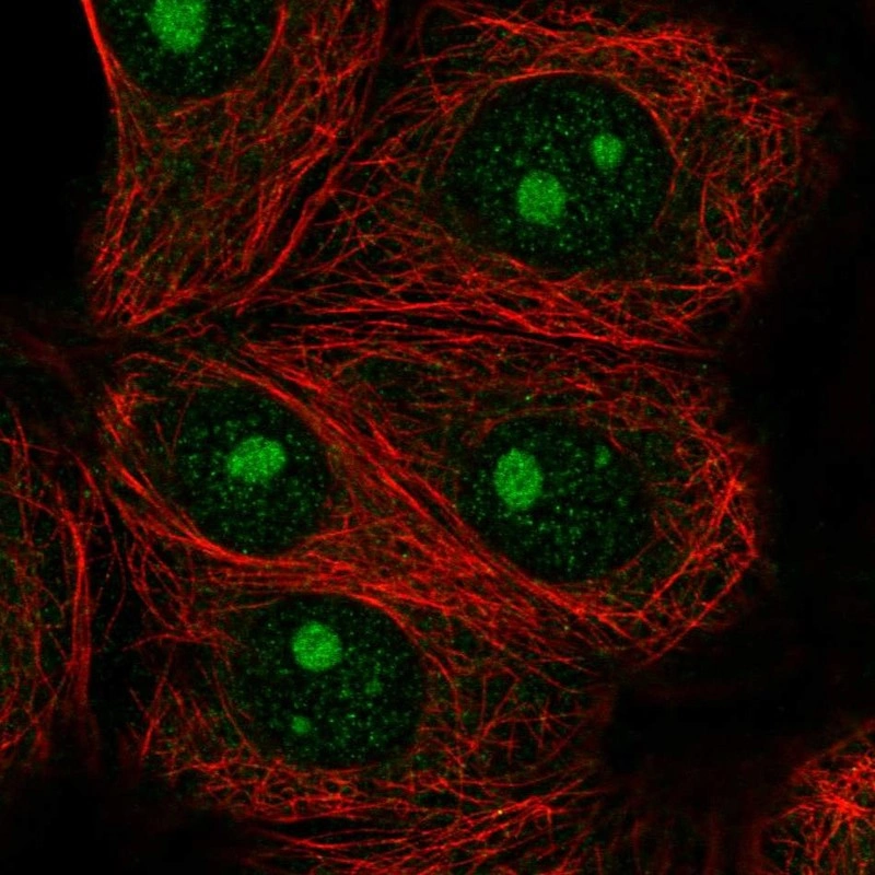 Immp4 Anti-IMP4 Human Protein Atlas Antibody