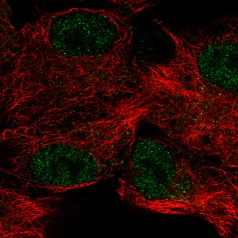 Rabbit Polyclonal Anti-CA12 Antibody - Buy for research - Highly ...