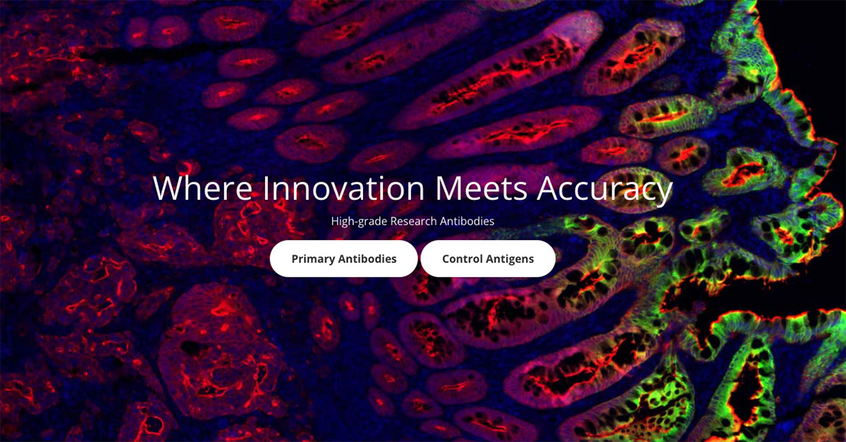 Human Protein Atlas Origins of Atlas Antibodies
