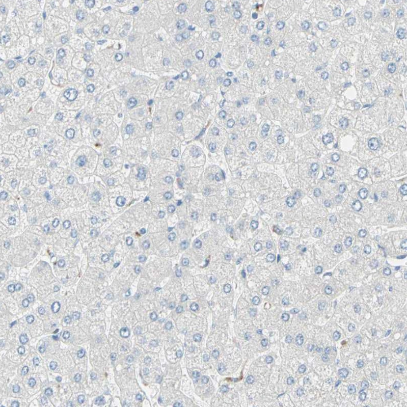 Anti-MFF Human Protein Atlas Antibody