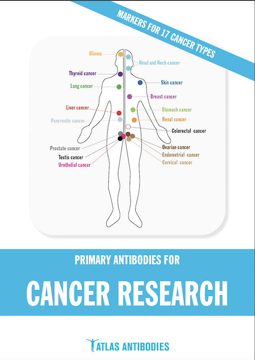 Atlas antibodies in cancer research