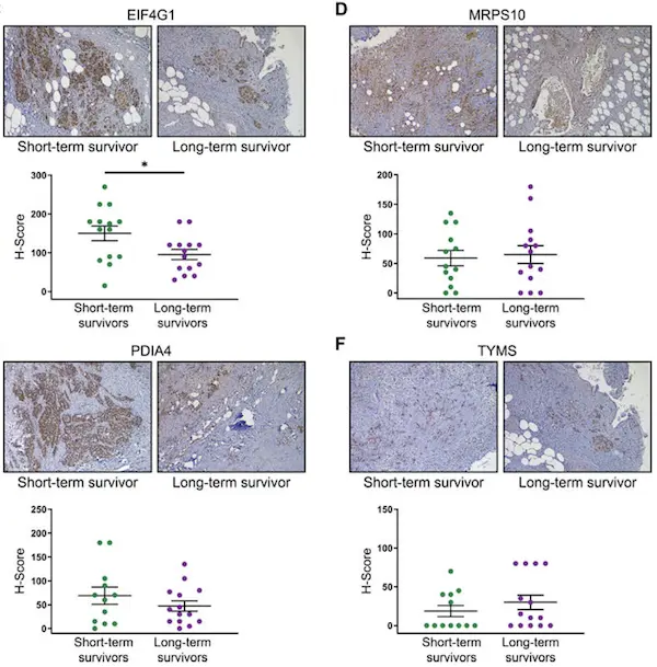 Triple A Polyclonals to validate key proteins in pancreatic cancer research