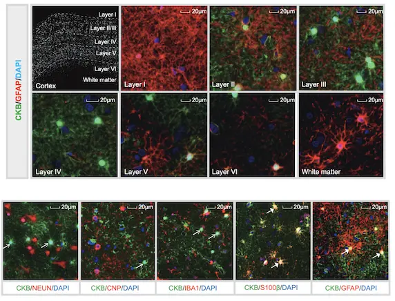 anti-CKB polyclonal atlas antibodies