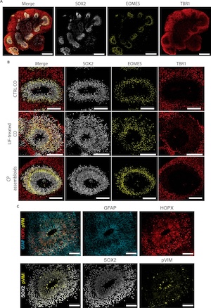 immunocytochemistry (ICC) and immunofluorescence (IF) techniques on brain organoids using Atlas Antibodies' anti-HOPX antibody (Cat. HPA030180). 