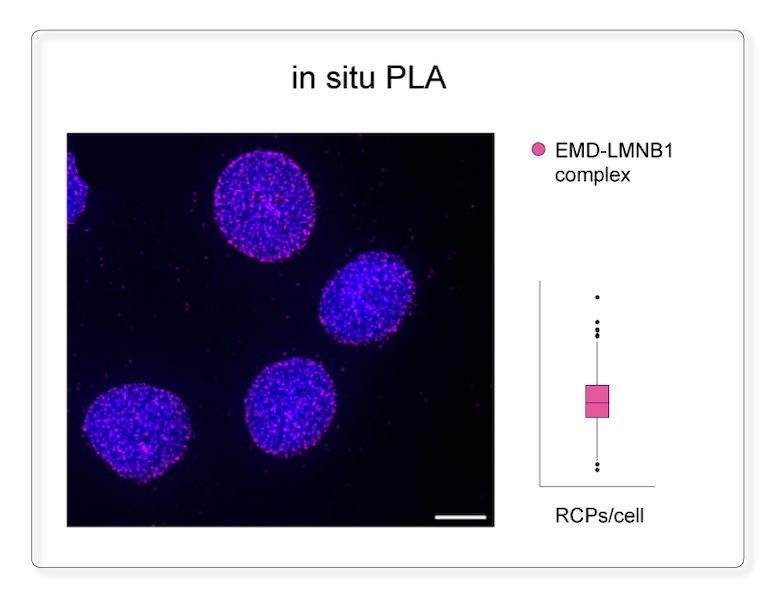 in situ Proximity Ligation Assay (inPLA) exclusively detects the EMD–LMNB1 complex